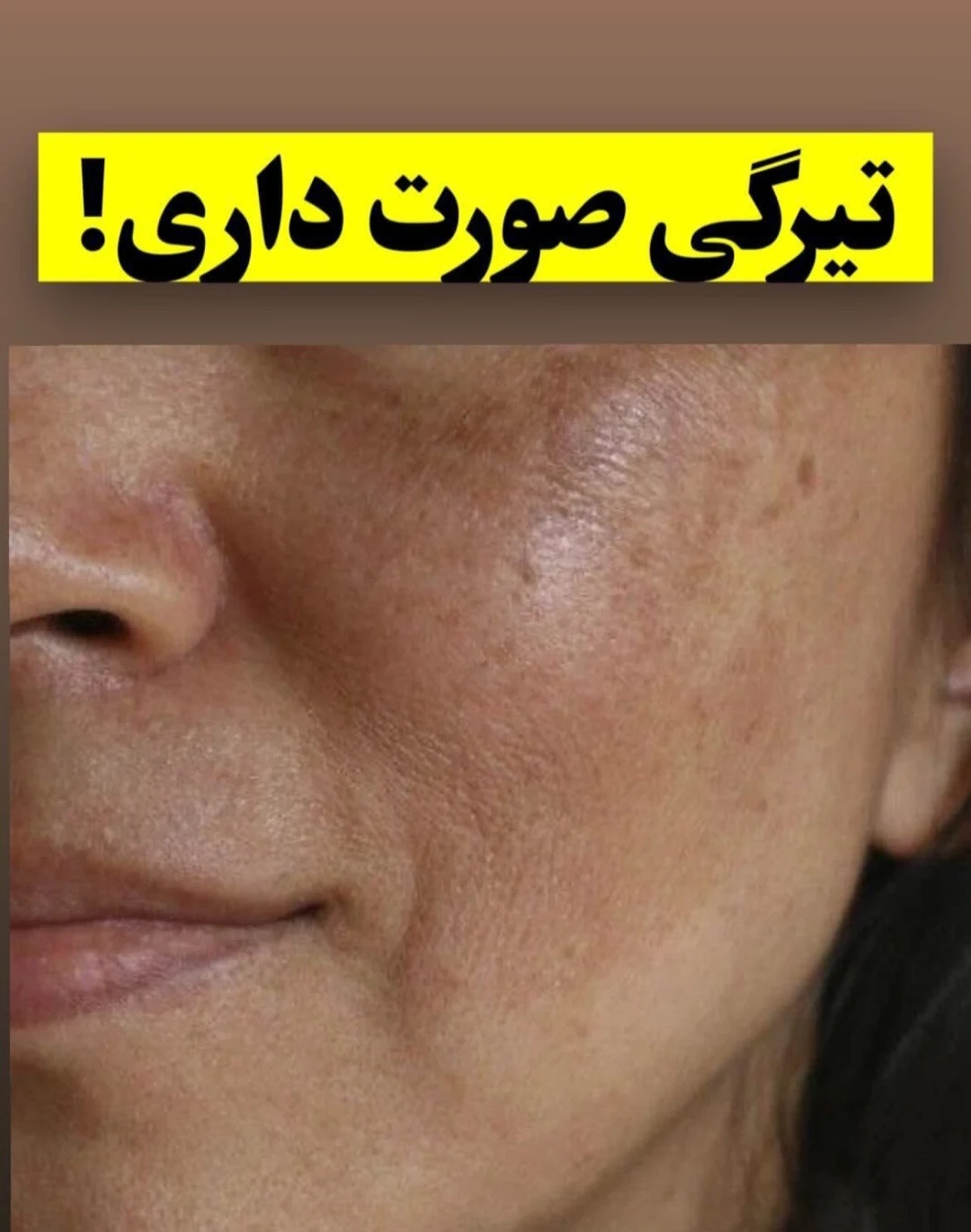 آرایشی و بهداشتی ملکا - تصویر 4