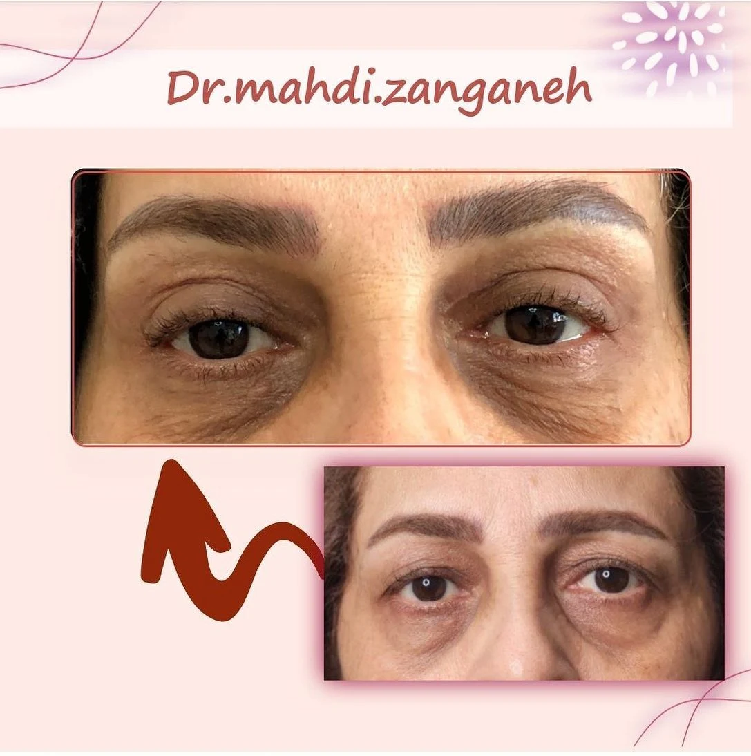 دکتر مهدی زنگانه