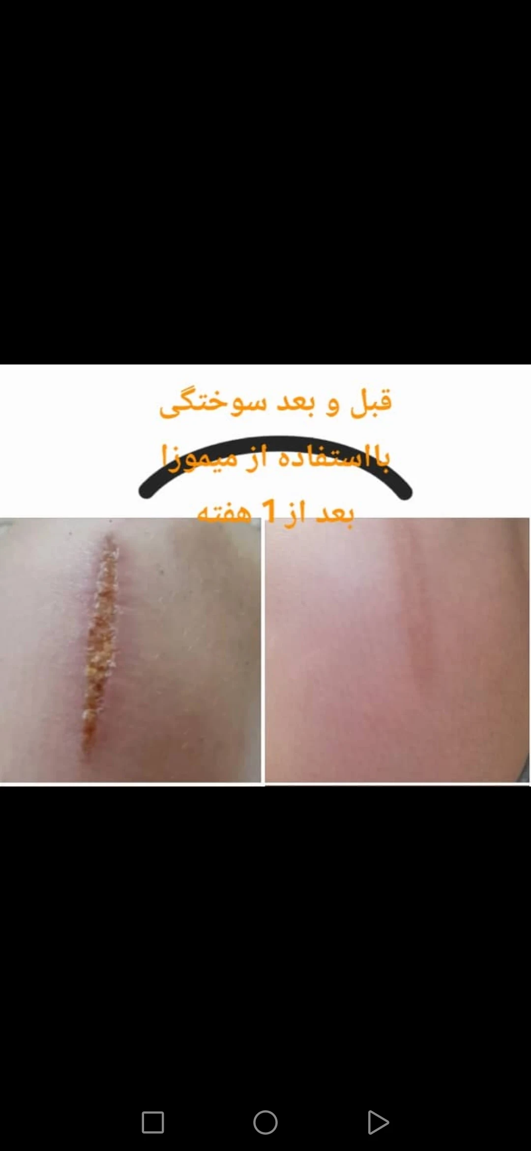 مشاور محصولات پوست و مو و سلامتی اکبرپور - تصویر 4