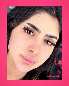 کاشت مژه نسترن