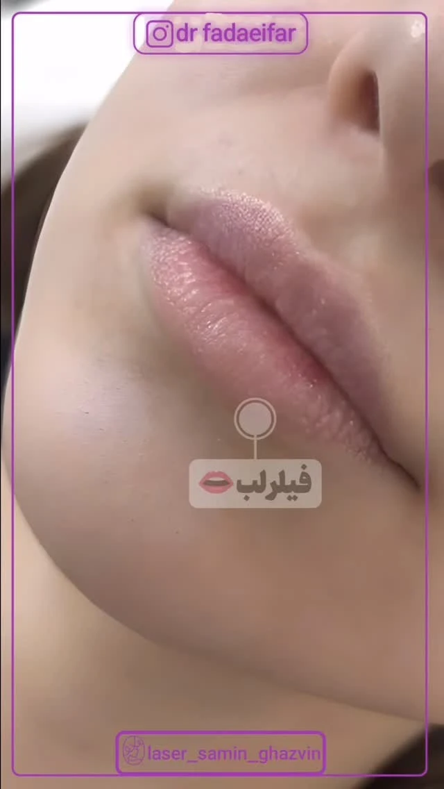 مرکز لیزر و زیبایی پوست سمین - تصویر 2