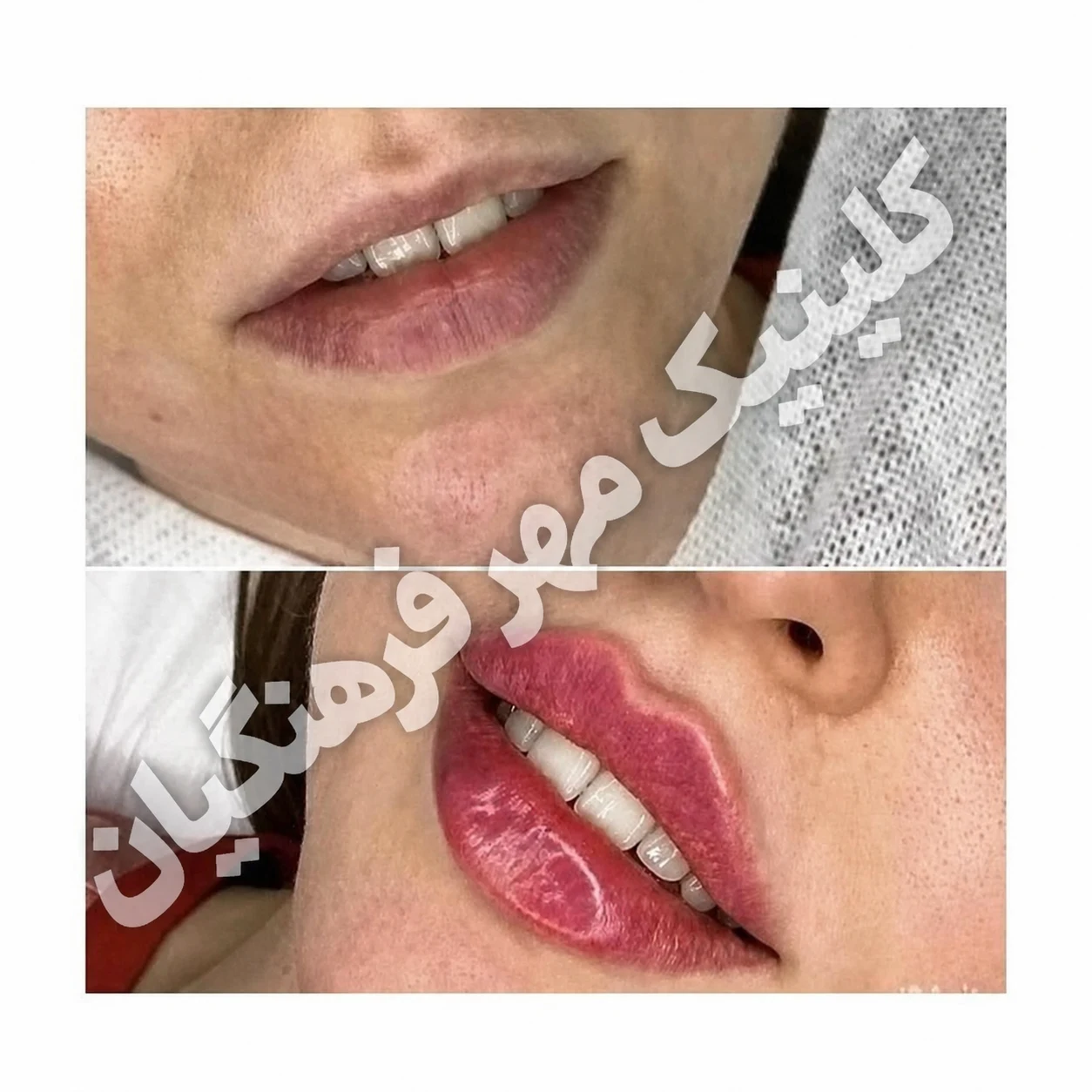 کلینیک پوست مو زیبایی و لاغری مهر فرهنگیان قزوین