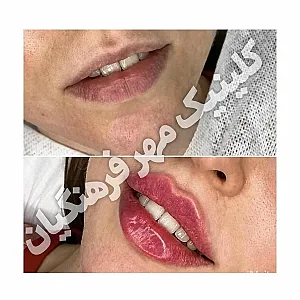 کلینیک پوست مو زیبایی و لاغری مهر فرهنگیان قزوین