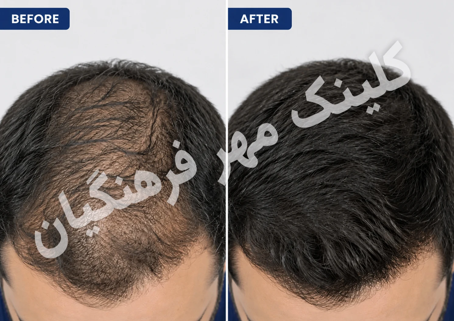 لوگوی کلینیک پوست مو زیبایی و لاغری مهر فرهنگیان قزوین