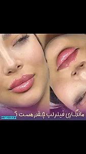 مطب زیبایی دکتر اشکان فرهادی