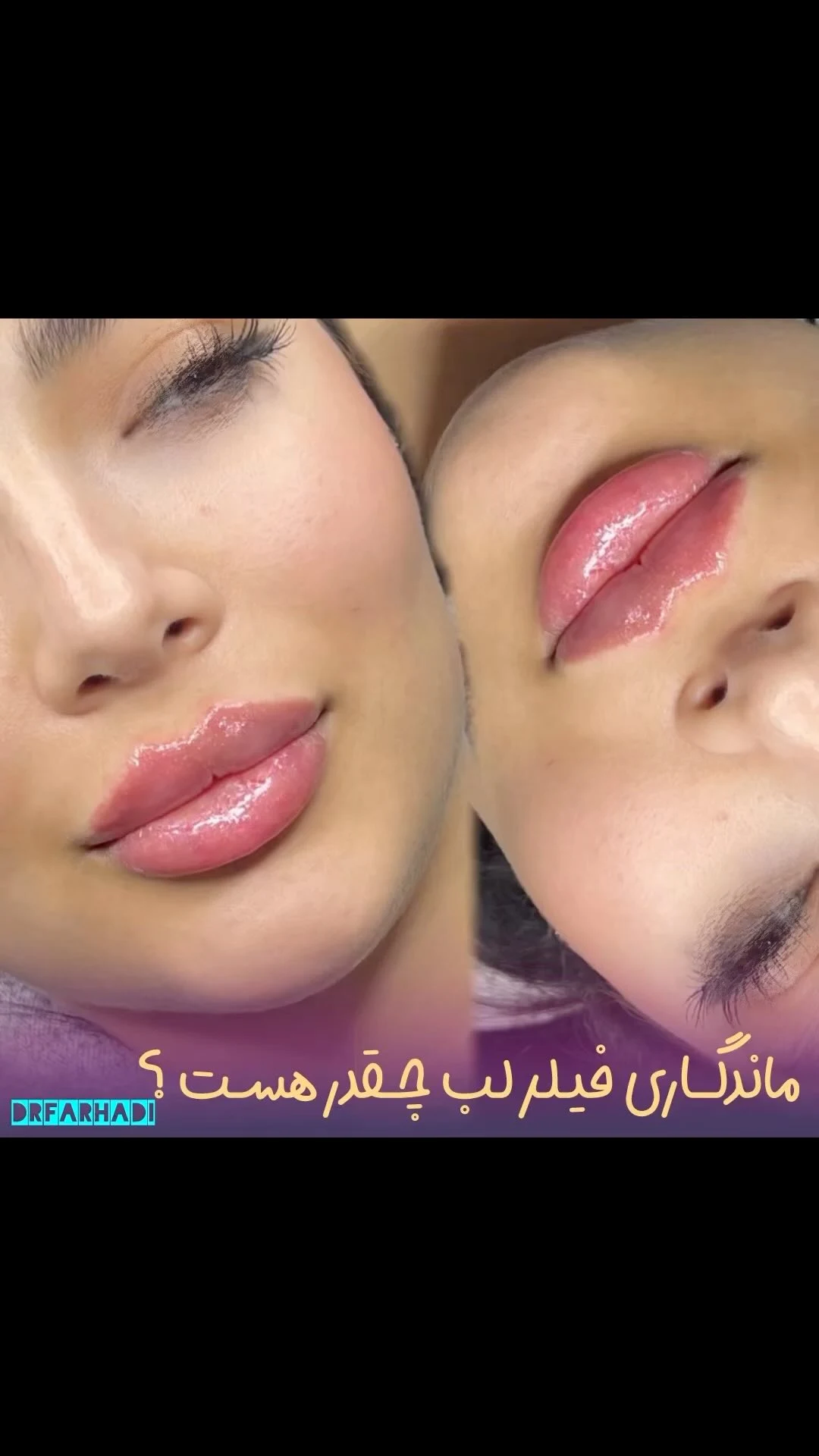 مطب زیبایی دکتر اشکان فرهادی