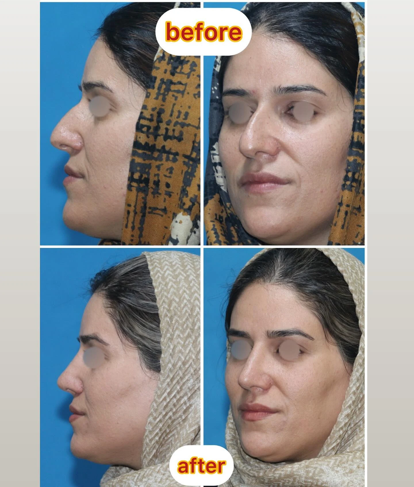 دکتر داریوش ناظمیان سلمان - جراح زیبایی و بینی در زنجان