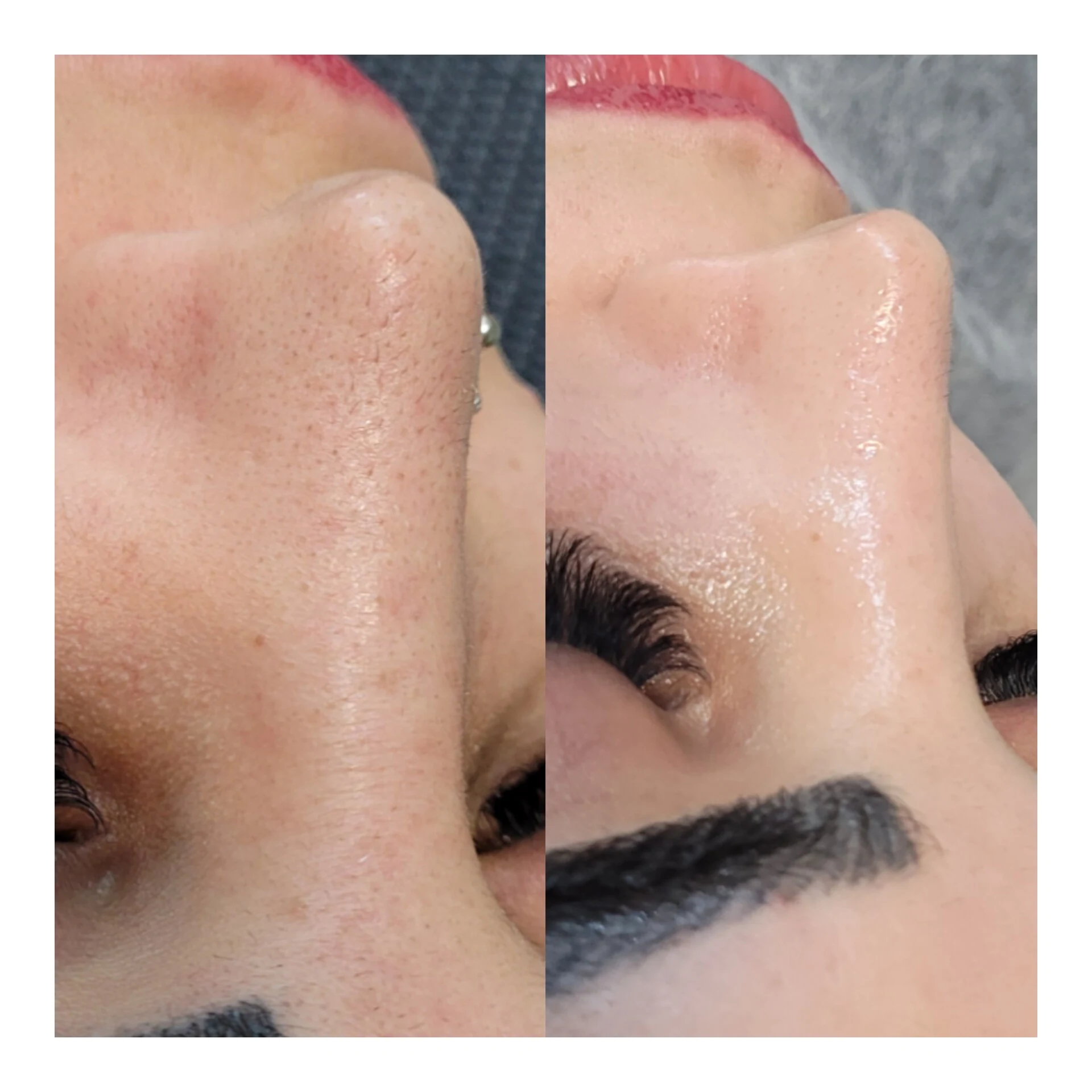 سالن پاکسازی پوست و فیشال لیلا