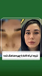 دکتر مشهود تقی لو