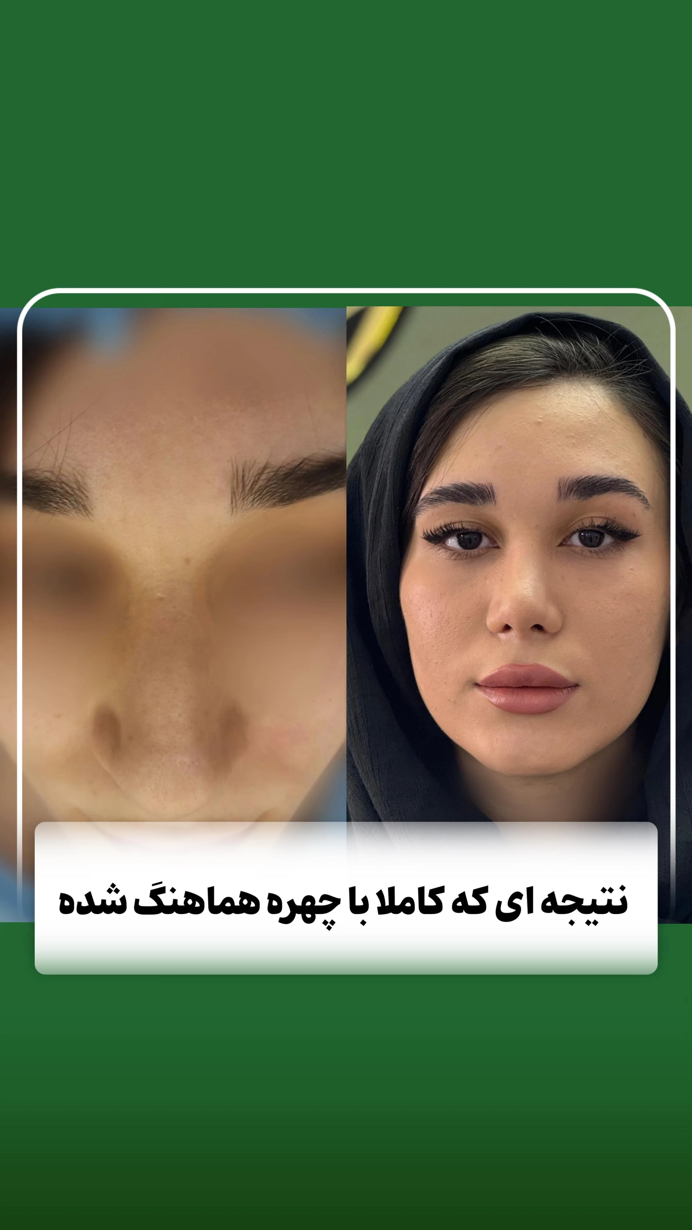 دکتر مشهود تقی لو - دکتر گوش و حلق و بینی در زنجان