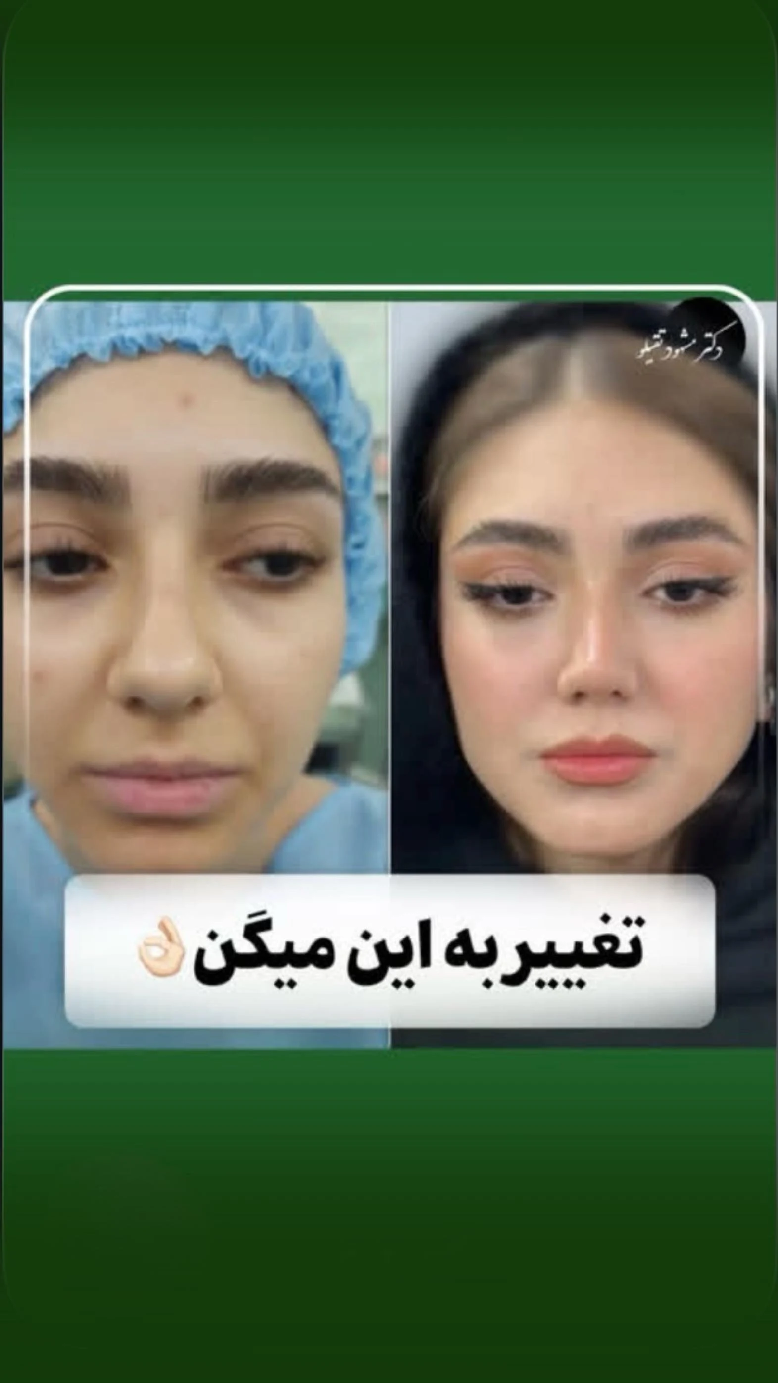 دکتر مشهود تقی لو - دکتر گوش و حلق و بینی در زنجان - تصویر 2