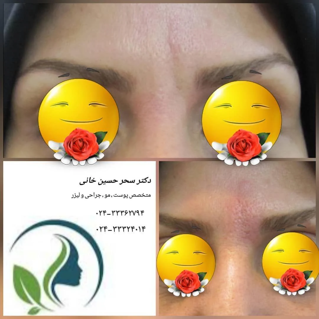 مطب زیبایی دکتر سحر حسین خانی - تصویر 4