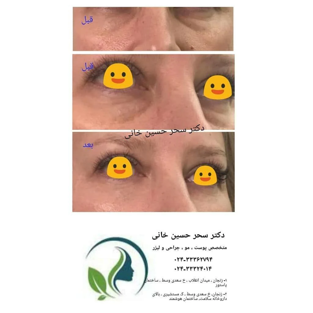 مطب زیبایی دکتر سحر حسین خانی - تصویر 5
