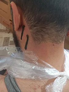 سلامتکده تخصصی حجامت وزالو(طب مهرداد )