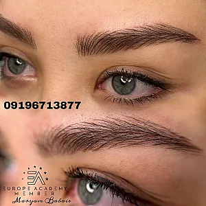 میکروبلیدینگ زنجان فیبروززنجان