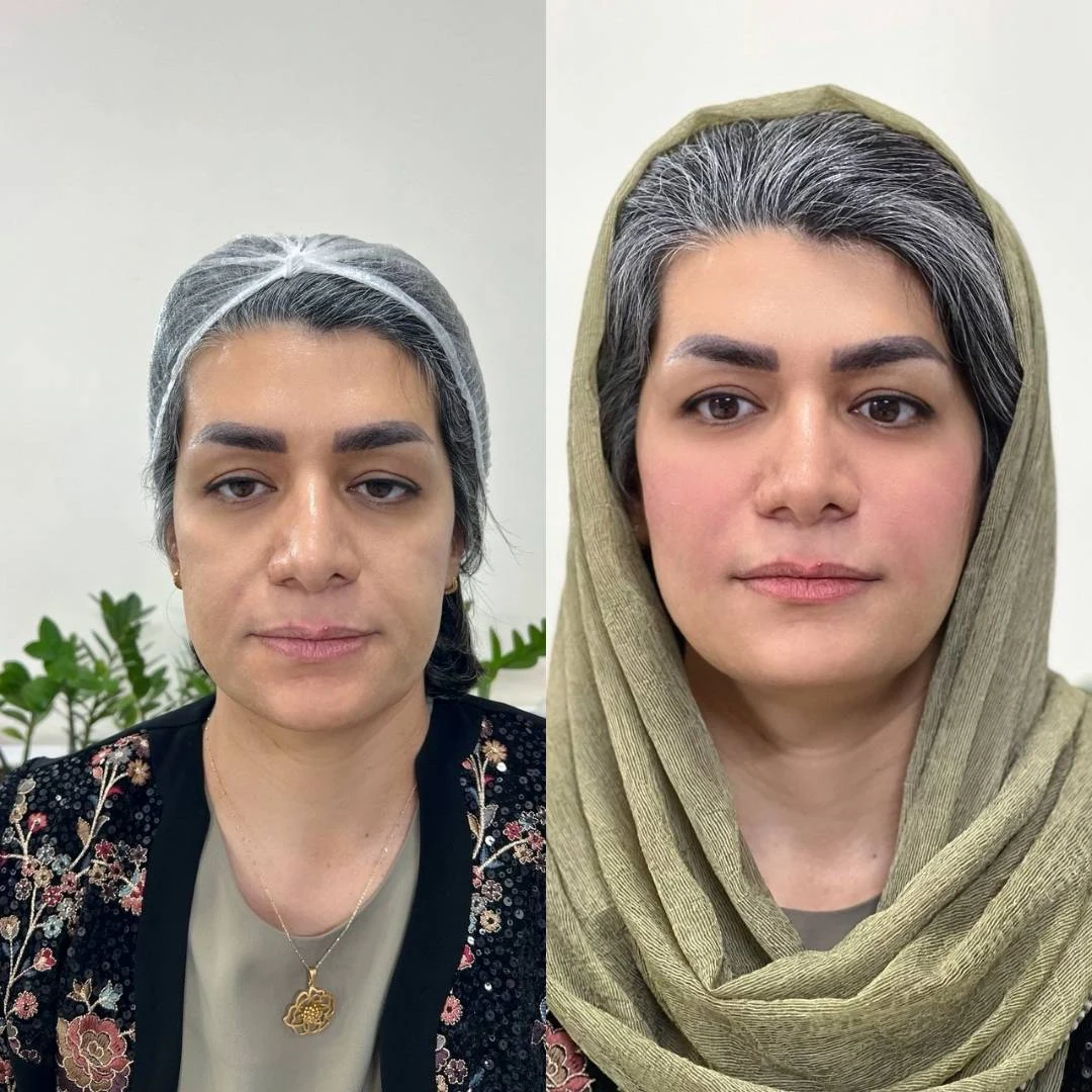کلینیک زیبایی دکتر یوسف زاده - تصویر 5