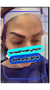 کلینیک کاشت مو و ابرو دنا