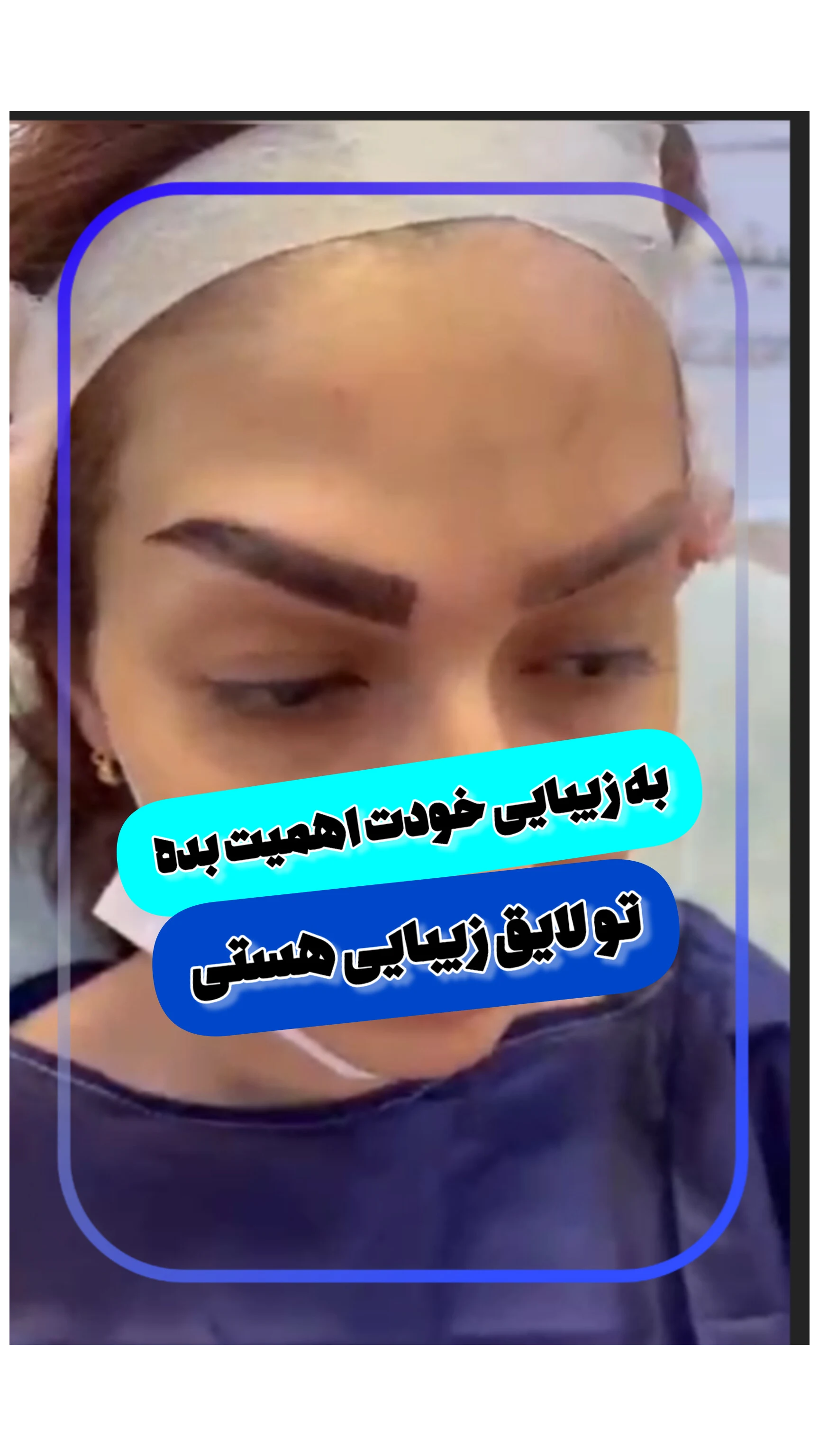 کلینیک کاشت مو و ابرو دنا