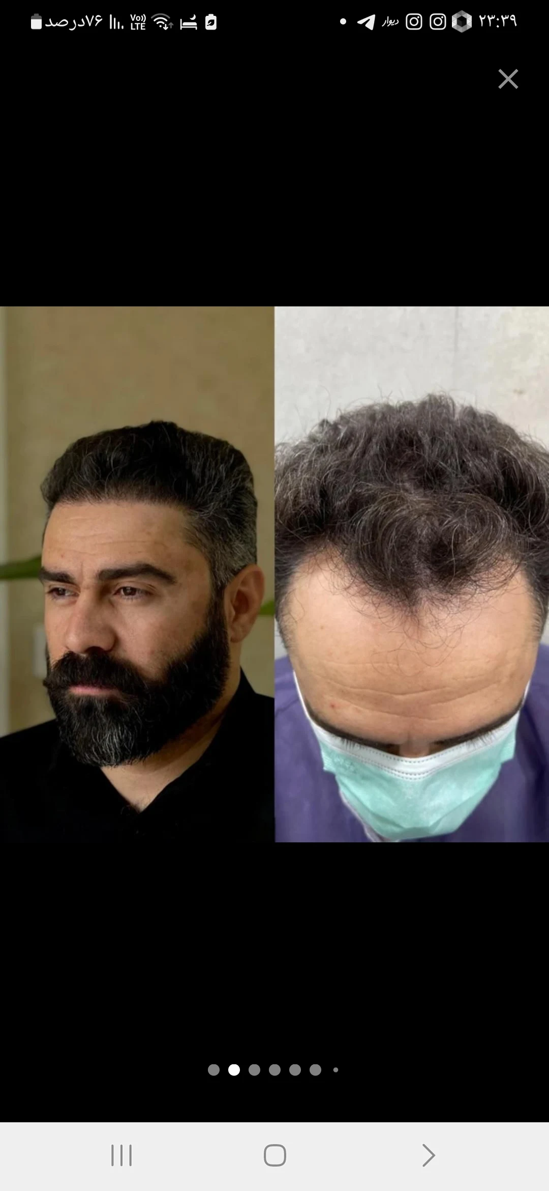 کلینیک کاشت مو و ابرو دنا - تصویر 2