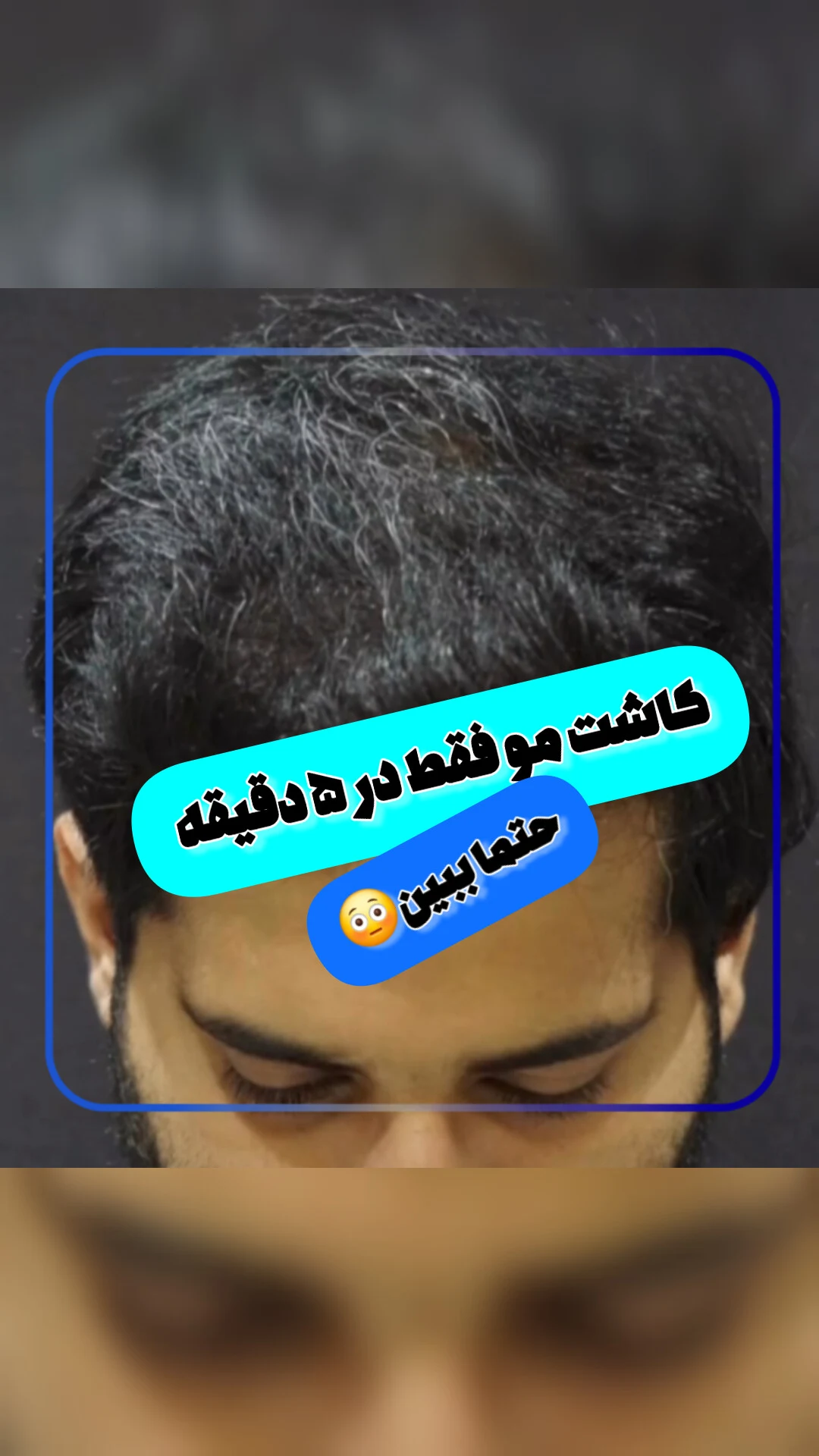 کلینیک کاشت مو و ابرو دنا - تصویر 3