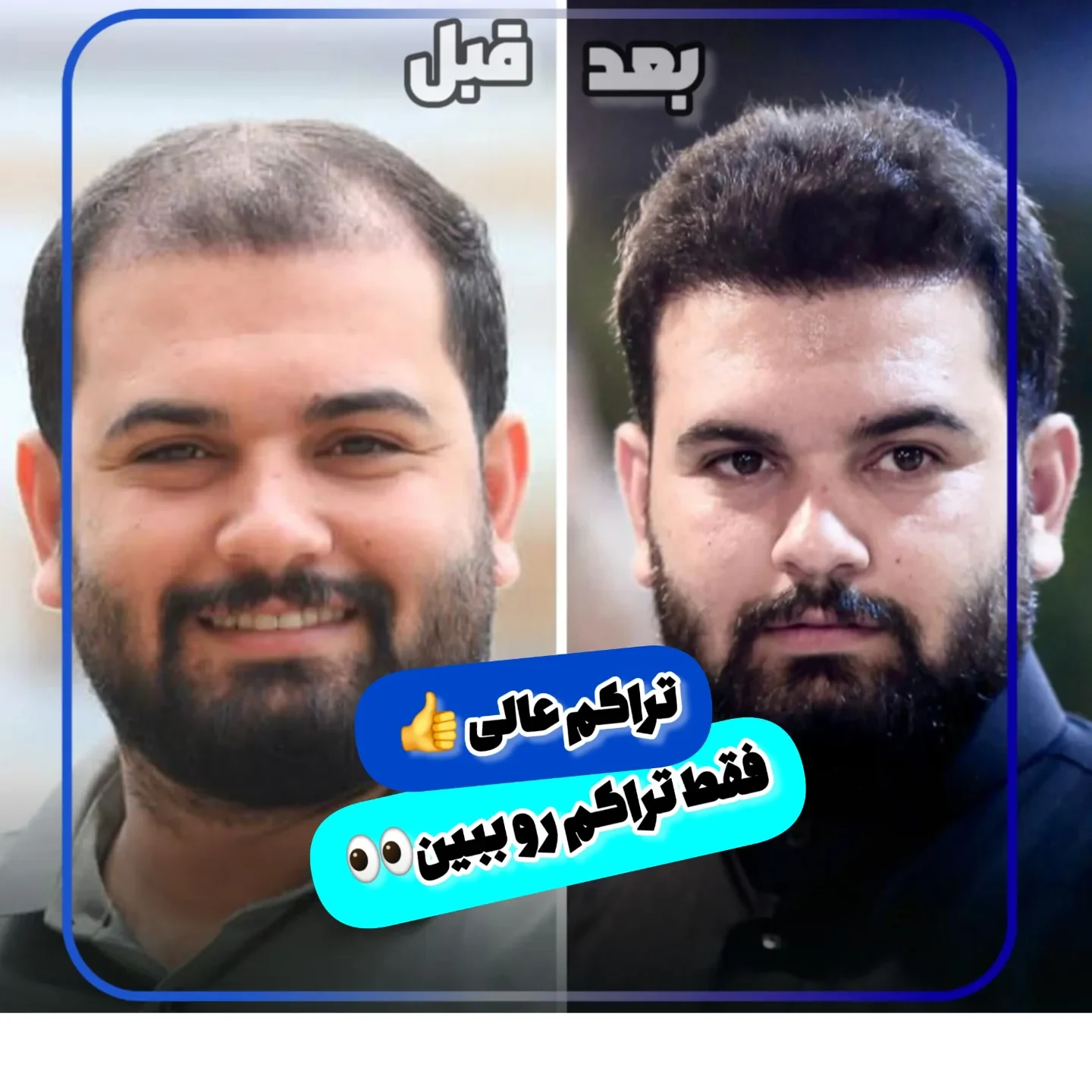 کلینیک کاشت مو و ابرو دنا - تصویر 4