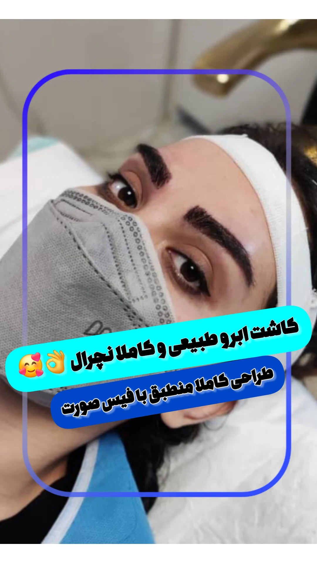 کلینیک کاشت مو و ابرو دنا - تصویر 5