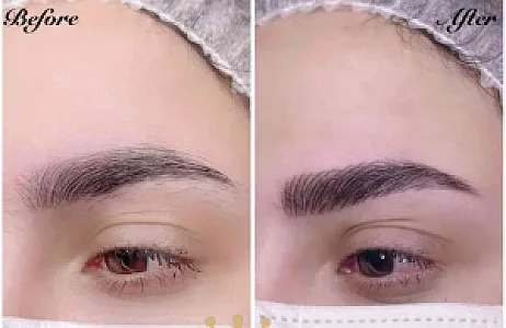 انجام خدمات میکروبلیدینگ ابرو