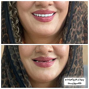مجموعه دندان پزشکی و دندان سازی نچرال