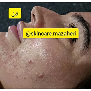 آموزشگاه پاکسازی پوست مظاهری
