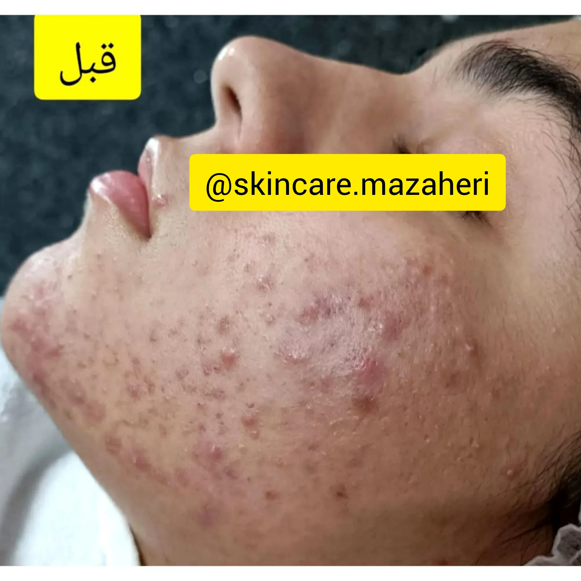 آموزشگاه پاکسازی پوست مظاهری - آموزشگاه آرایشگری در اراک - تصویر 2