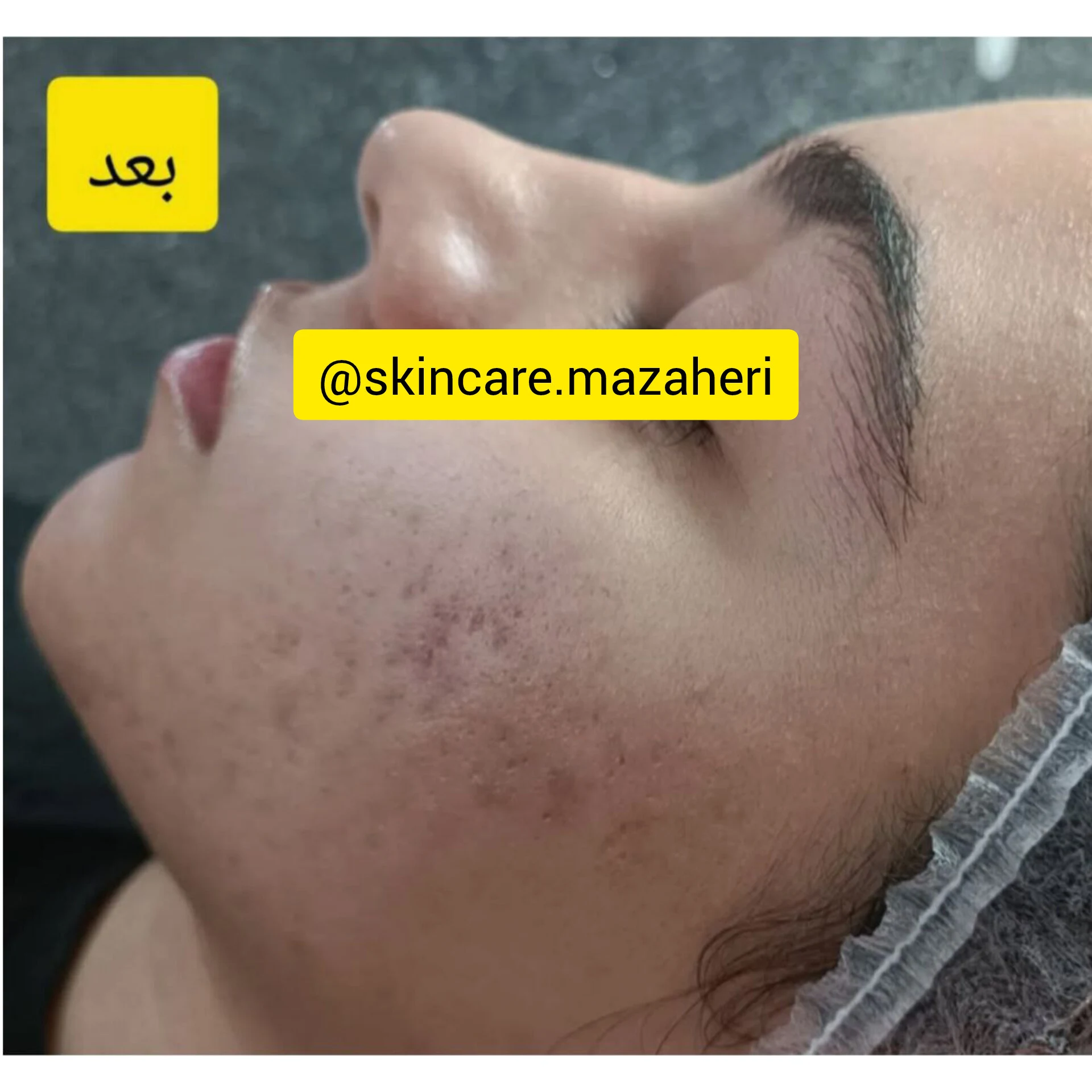 آموزشگاه پاکسازی پوست مظاهری - آموزشگاه آرایشگری در اراک - تصویر 3