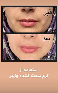 مشاوره تخصصی  پوست مو  رایگان