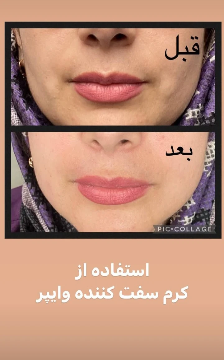 مشاوره تخصصی  پوست مو  رایگان - کلینیک پوست و زیبایی در اراک