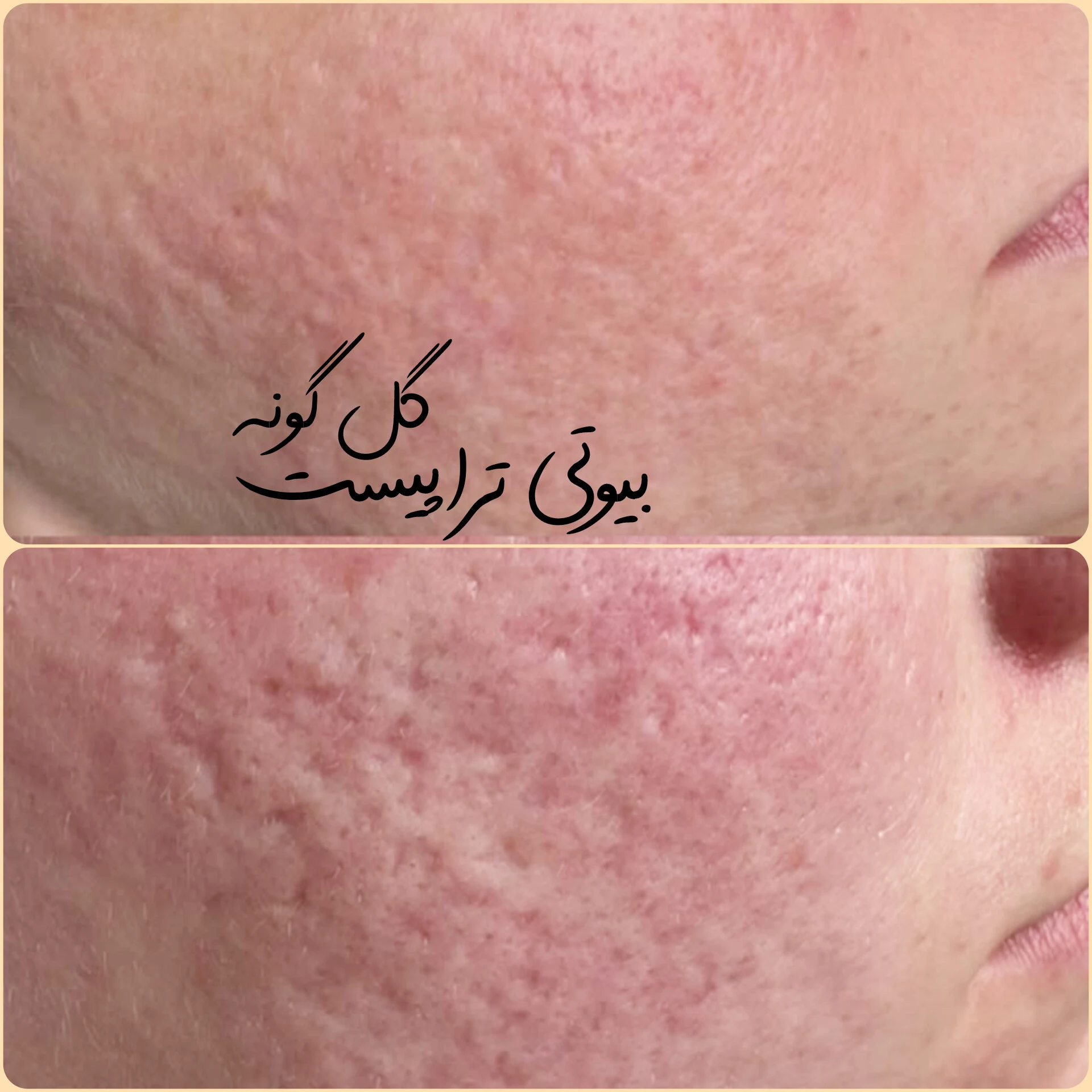 پاکسازی پوست اراک - کلینیک پوست و زیبایی در اراک - تصویر 3