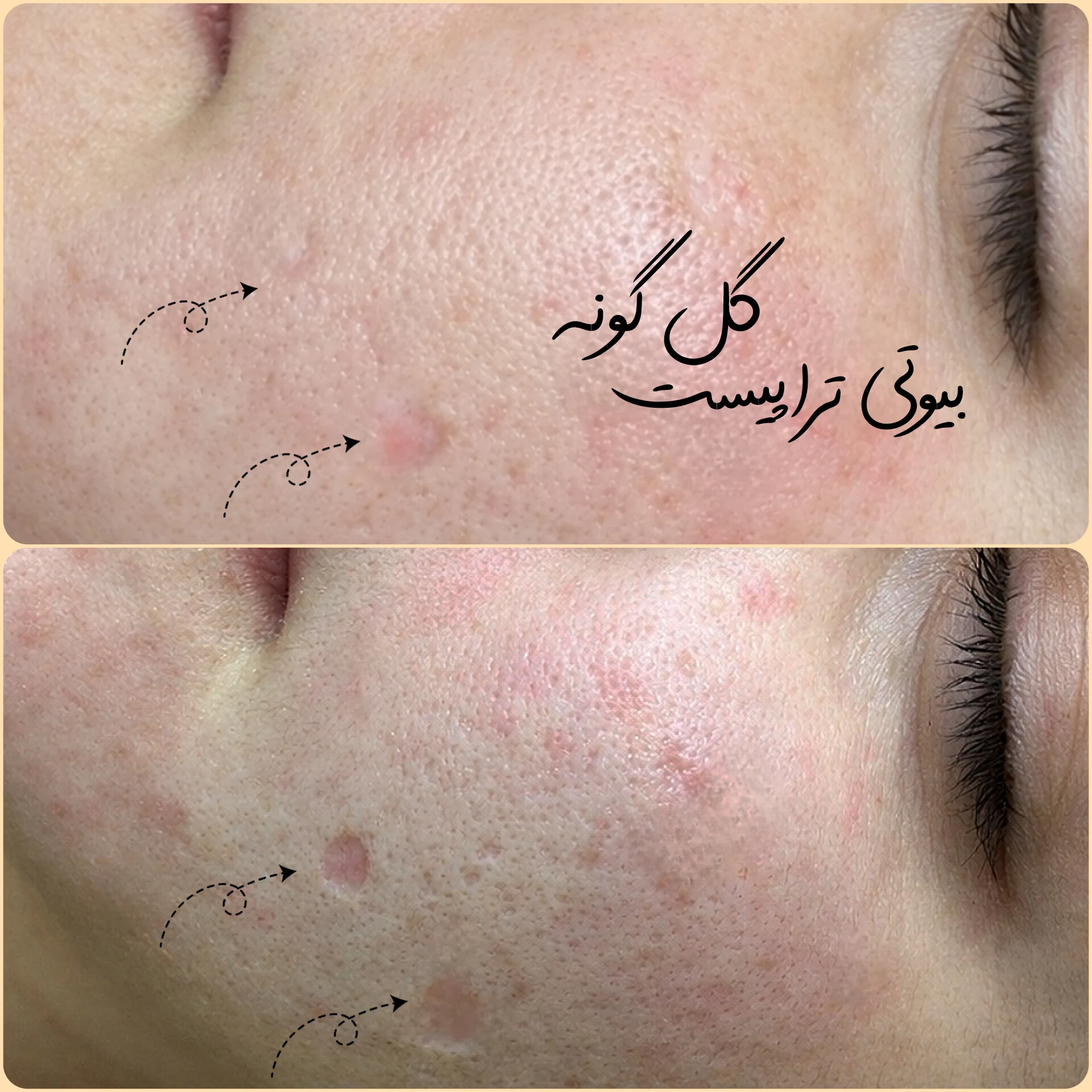 پاکسازی پوست اراک - کلینیک پوست و زیبایی در اراک - تصویر 5