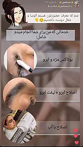 خدمات تخصصی ابرو آتوسا