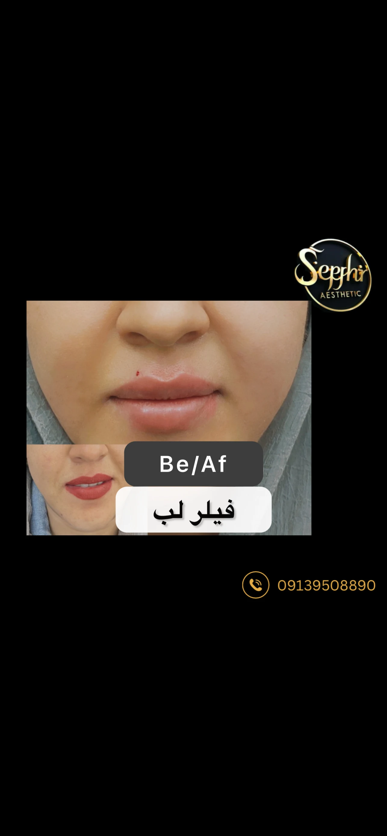 خدمات زیبایی میترا پورحاجی - کلینیک پوست و زیبایی در کرمان