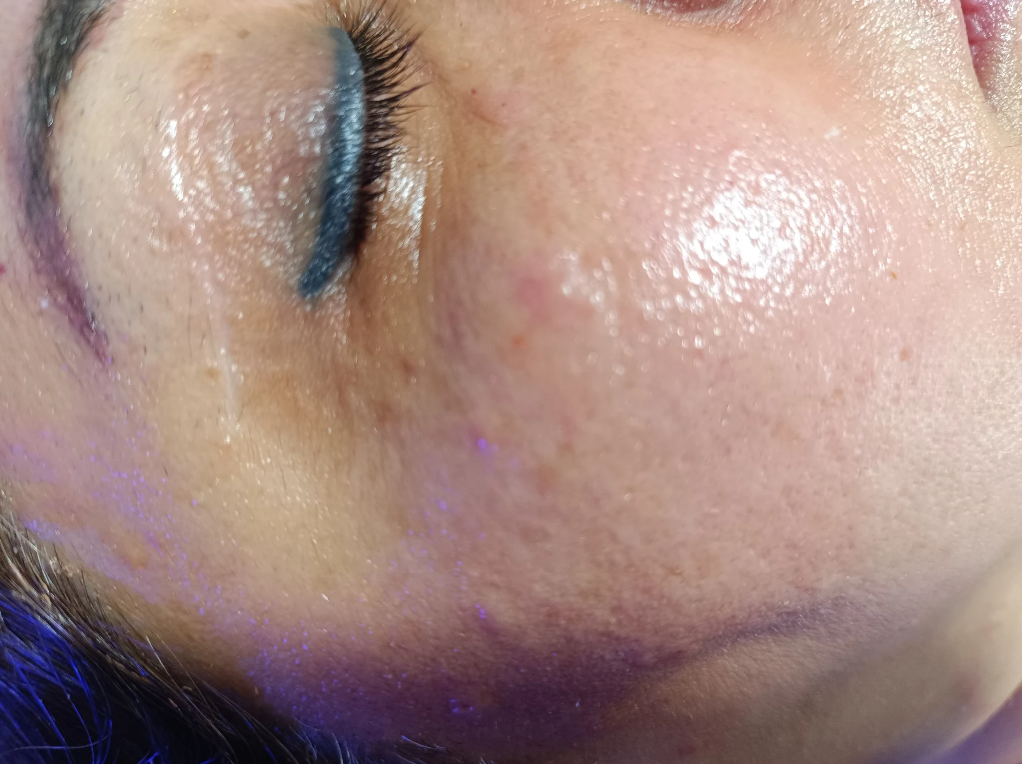 خدمات پاکسازی زیبایی و درمانی خضری پور - تصویر 2