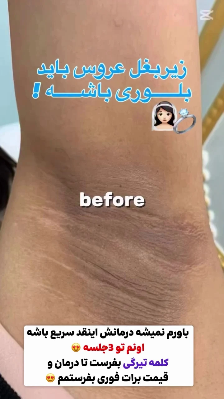 خدمات پاکسازی زیبایی و درمانی خضری پور - تصویر 4