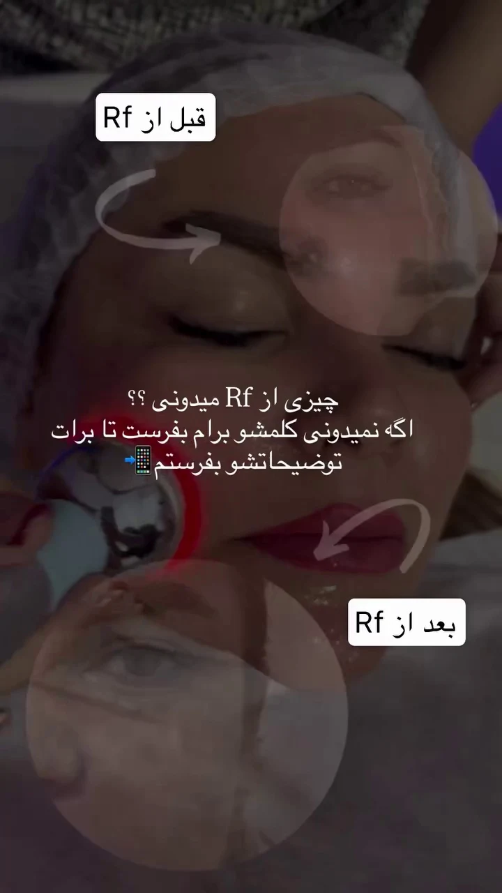 خدمات پاکسازی زیبایی و درمانی خضری پور - تصویر 5