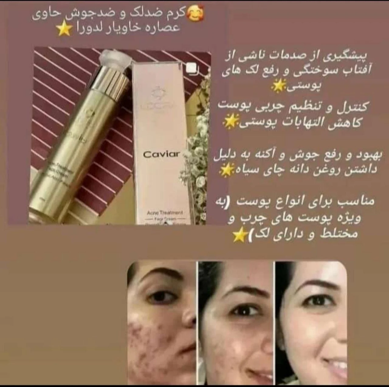 محصولات آرایشی لدورا بیوتی