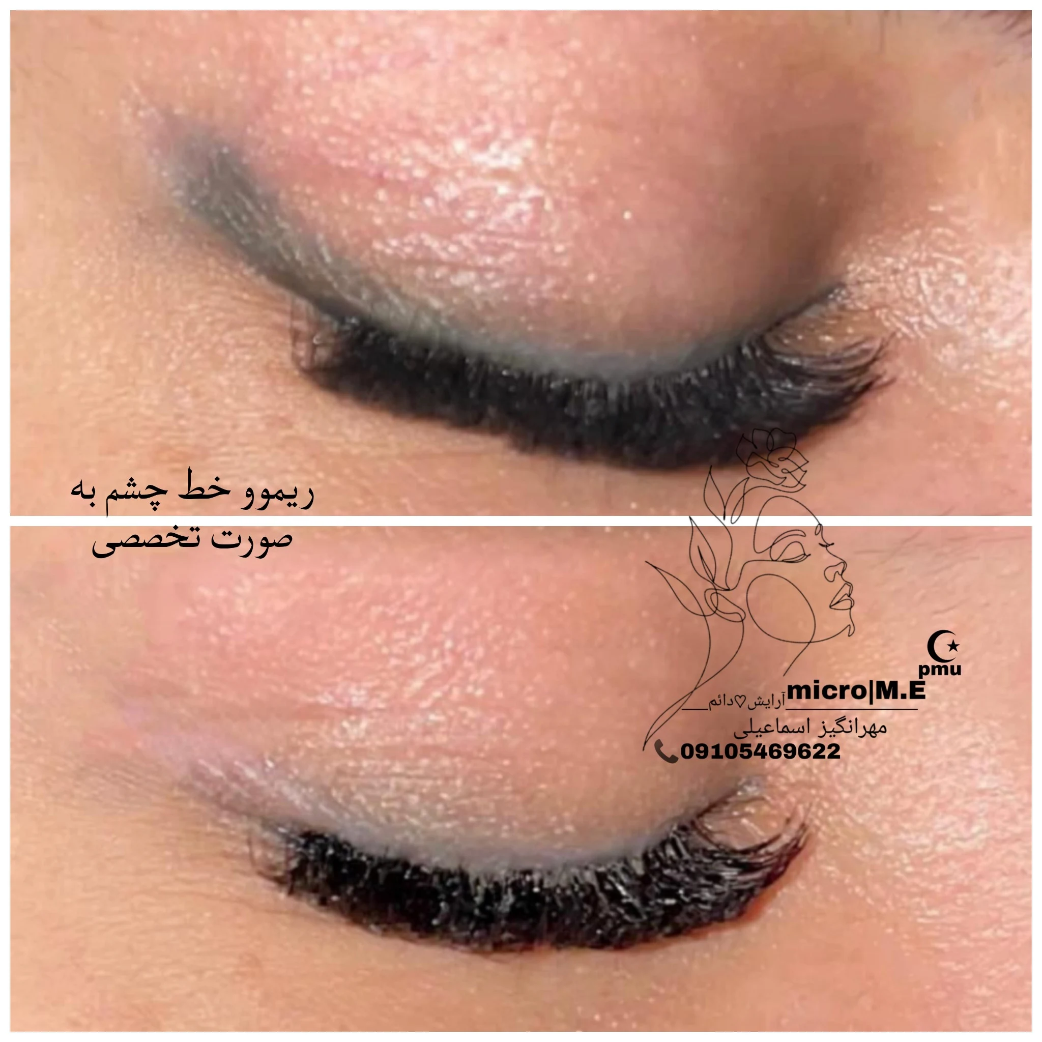 مهرانگیز اسماعیلی آرایش دائم - تصویر 3