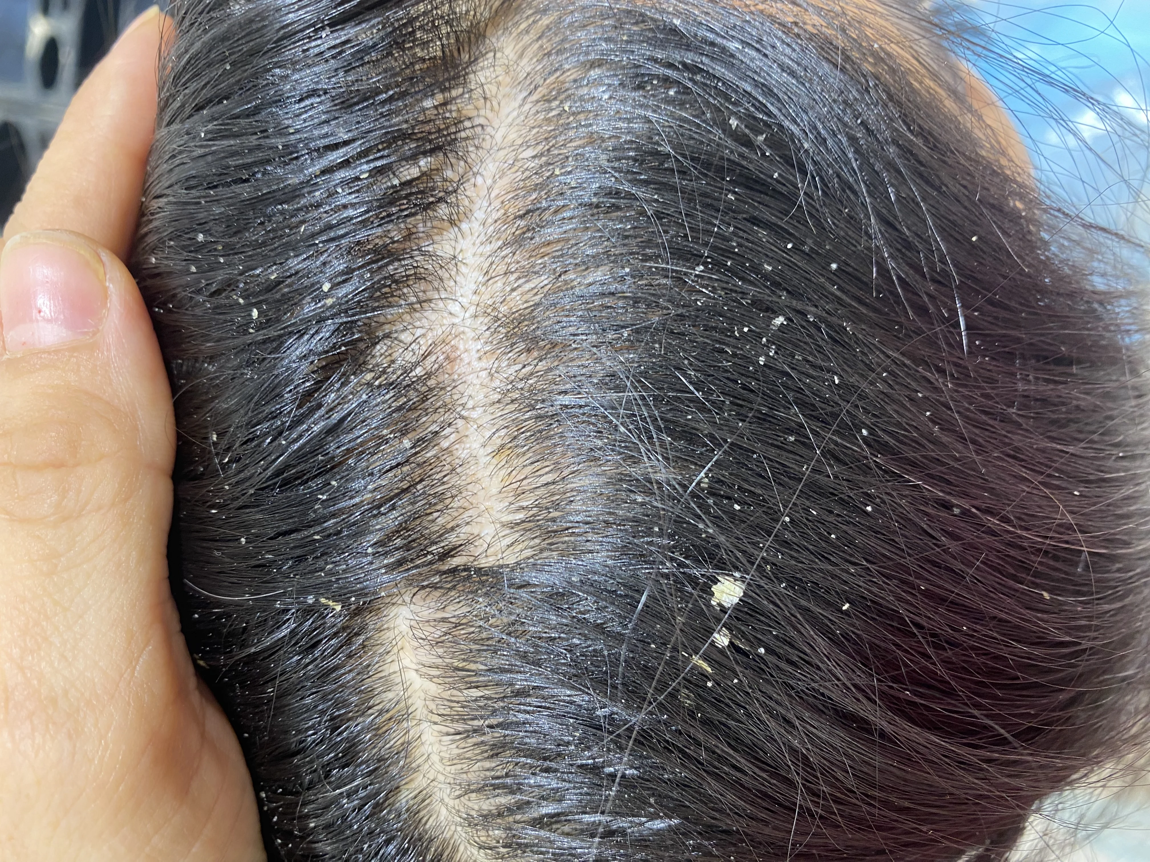 خدمات اسکراب اسکالپ ‌و کراتین ندا - تصویر 2
