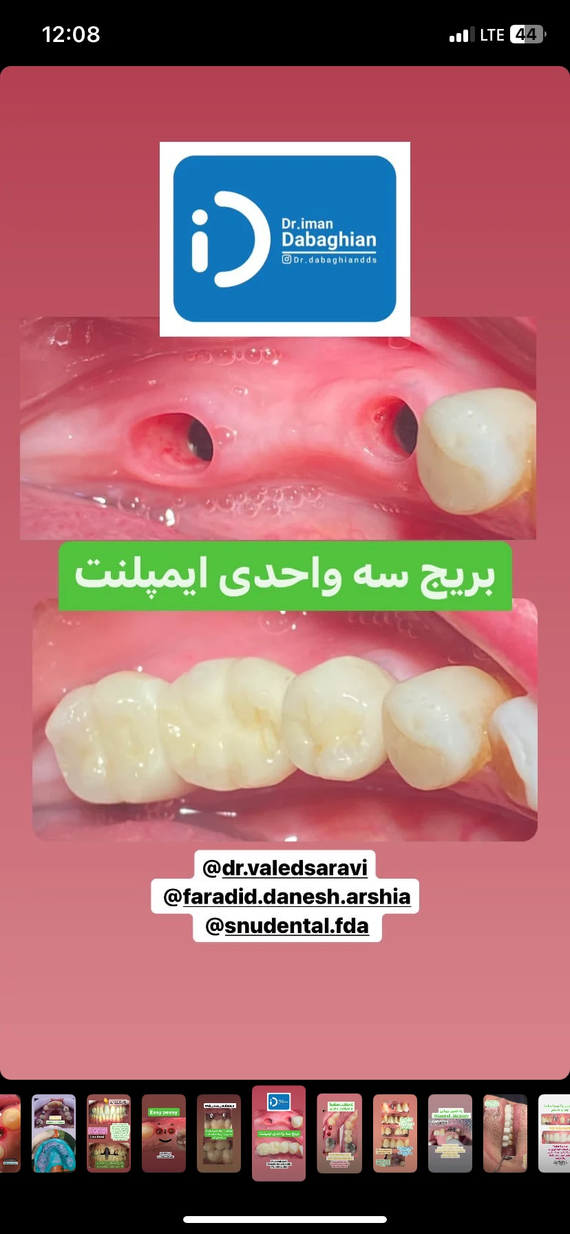 مطب دندانپزشکی دکتر  ایمان دباغیان - تصویر 4