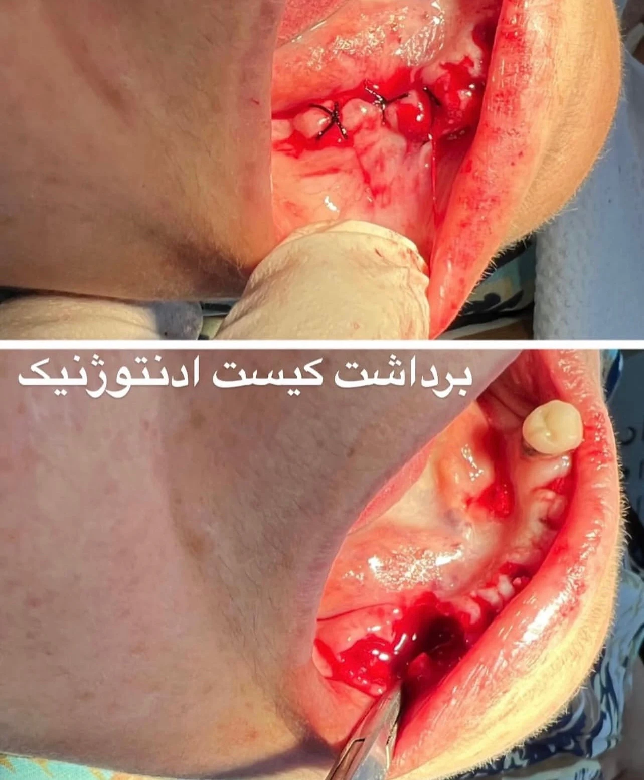 دندانپزشکی دکتر بهروز فلکی - تصویر 4