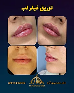 مطب زیبایی دکتر محسن پورآریا