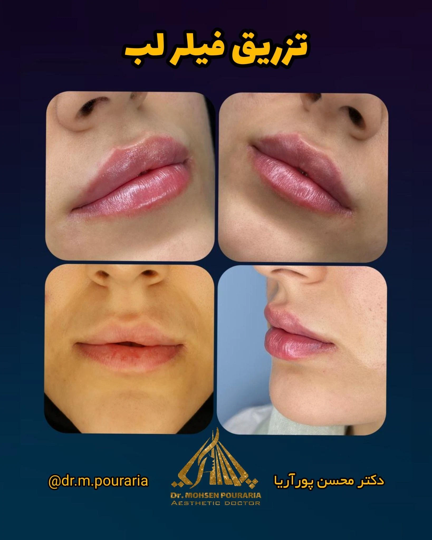 مطب زیبایی دکتر محسن پورآریا