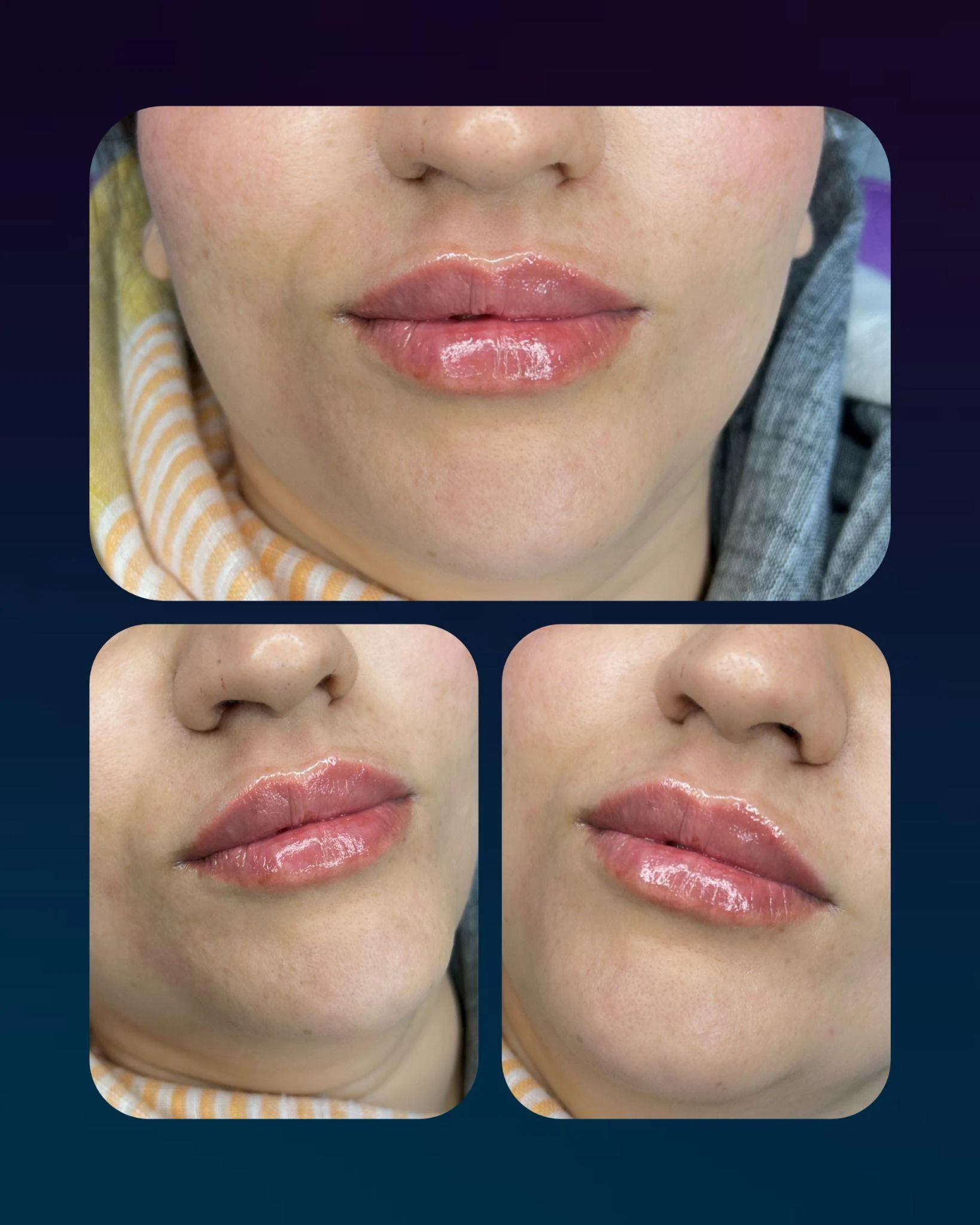 مطب زیبایی دکتر محسن پورآریا - تصویر 2