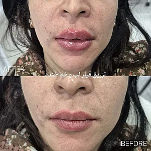 کلینیک لیزر و زیبایی دکتر لیلا حسینی