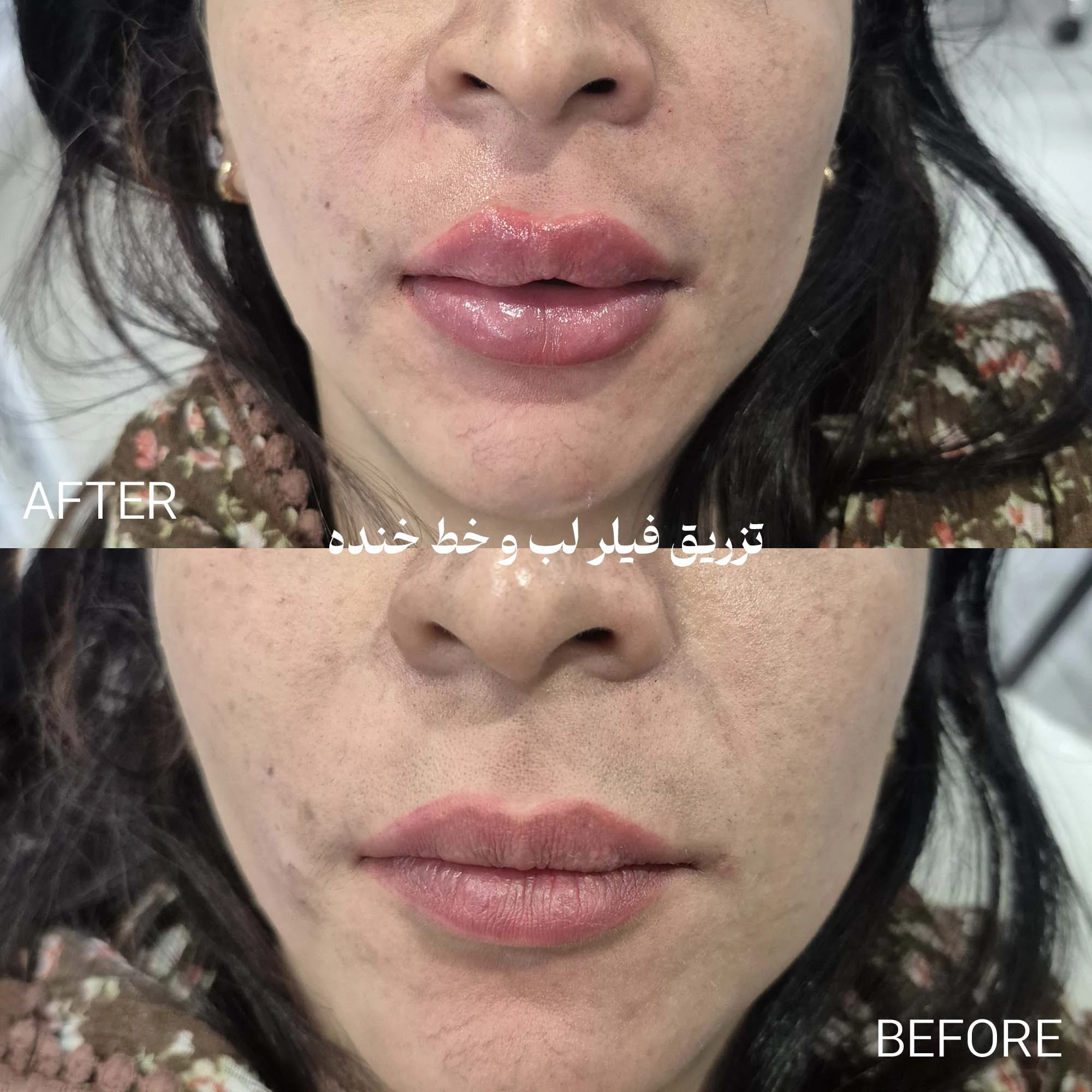 کلینیک لیزر و زیبایی دکتر لیلا حسینی